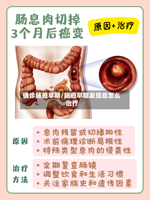 确诊肠癌早期/肠癌早期发现后怎么治疗-第2张图片