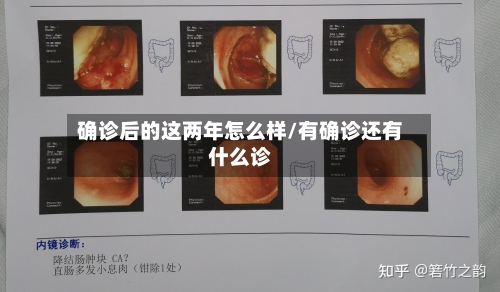 确诊后的这两年怎么样/有确诊还有什么诊-第3张图片