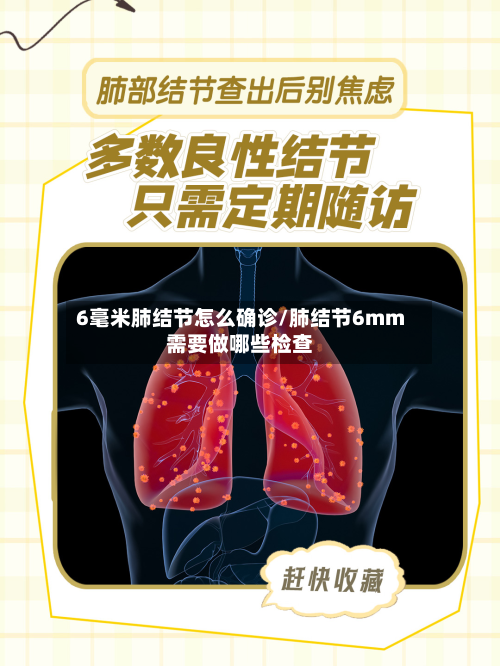 6毫米肺结节怎么确诊/肺结节6mm需要做哪些检查