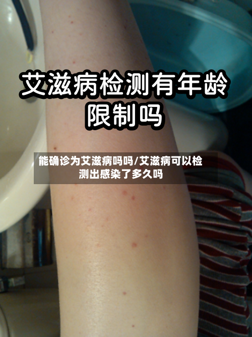 能确诊为艾滋病吗吗/艾滋病可以检测出感染了多久吗-第2张图片