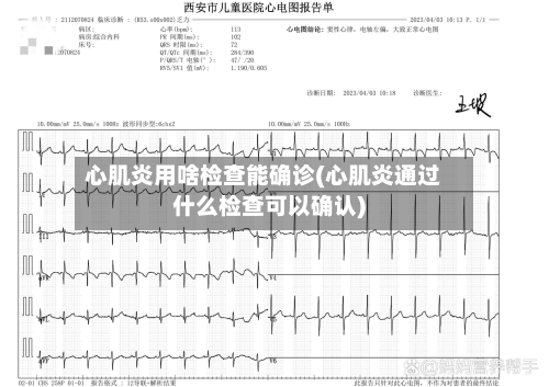 心肌炎用啥检查能确诊(心肌炎通过什么检查可以确认)-第3张图片