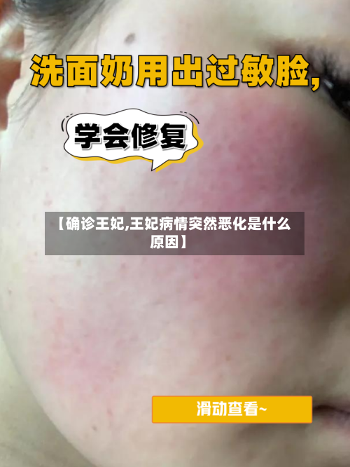 【确诊王妃,王妃病情突然恶化是什么原因】