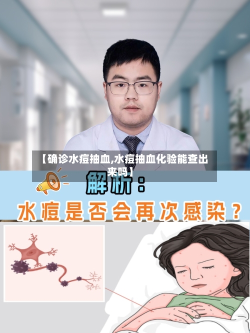 【确诊水痘抽血,水痘抽血化验能查出来吗】
