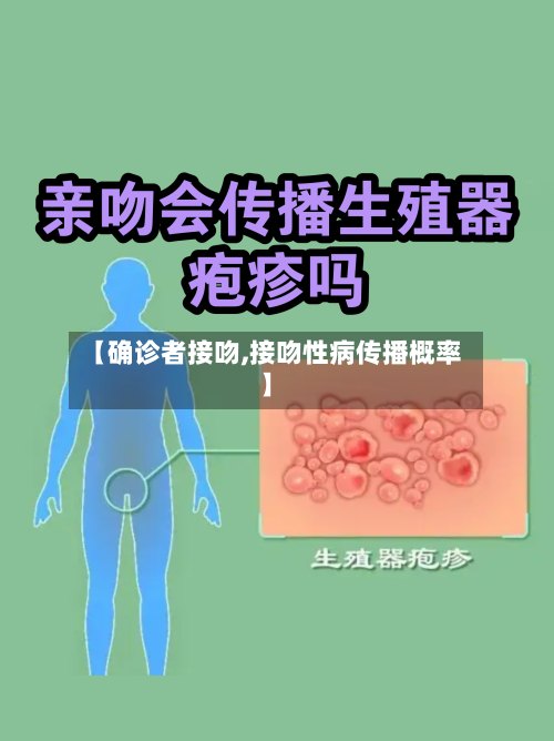 【确诊者接吻,接吻性病传播概率】