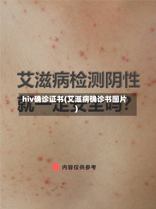 hiv确诊证书(艾滋病确诊书图片)-第3张图片
