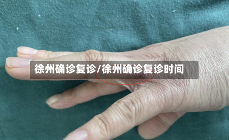 徐州确诊复诊/徐州确诊复诊时间