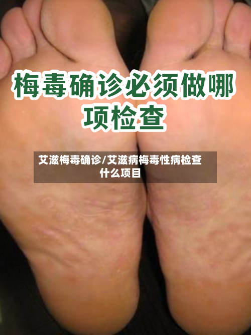 艾滋梅毒确诊/艾滋病梅毒性病检查什么项目